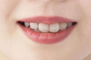 金沢で脱毛を受けたい人におすすめです